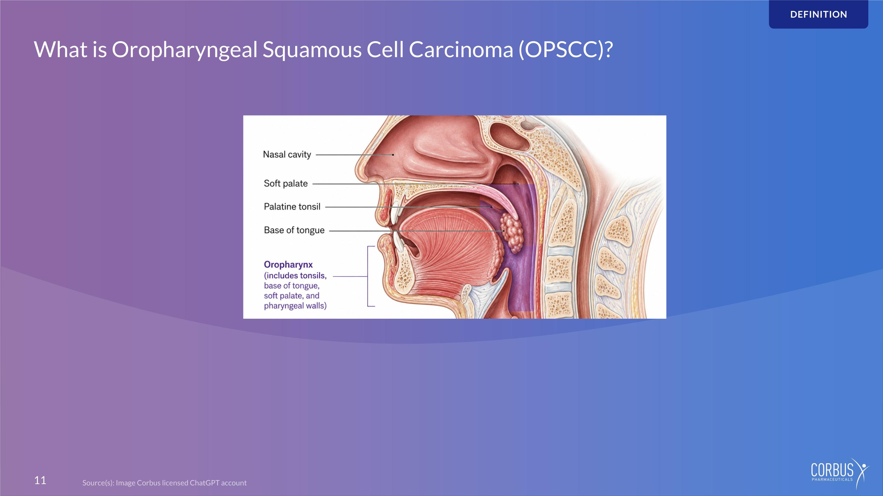 Slide 11